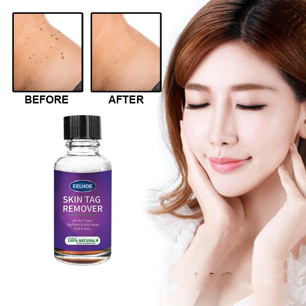 Foreign Trade Cross-Border Eelhoe Skin Verrucous Remover To Solve Skin Verrucous